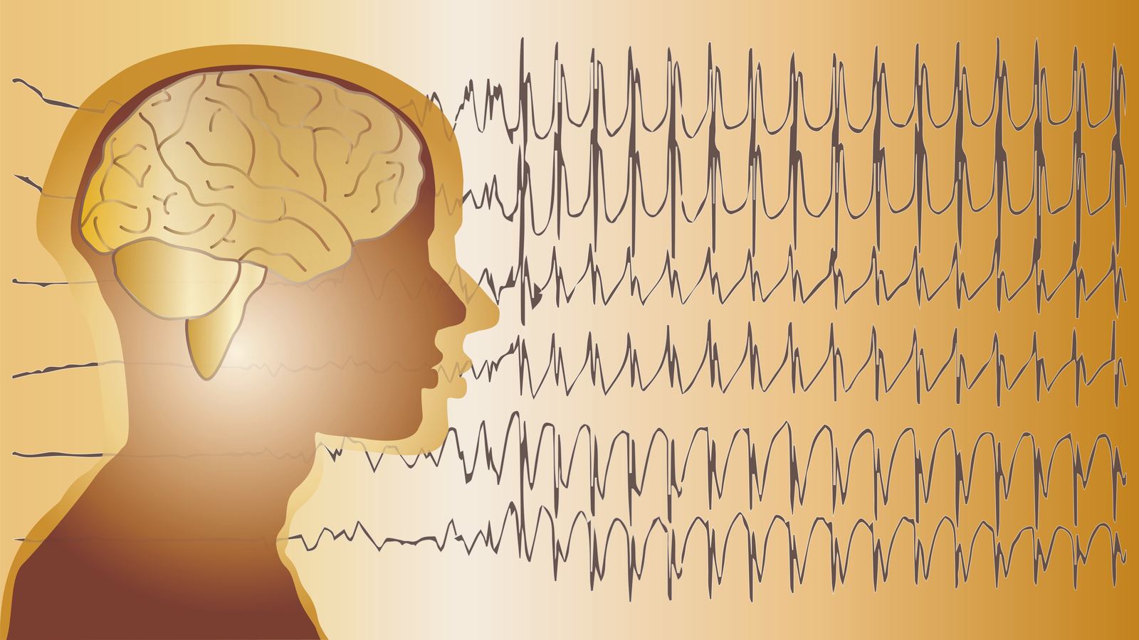 בדיקת EEG